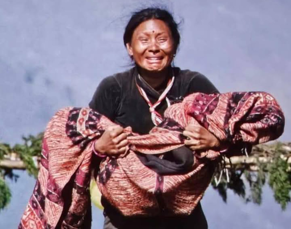 'लाज शरणम्’मा कुपोषित बालकको पात्रका रुपमा चित्रण गरिएका १६ वर्षीय विकास केसीको मृत्यु